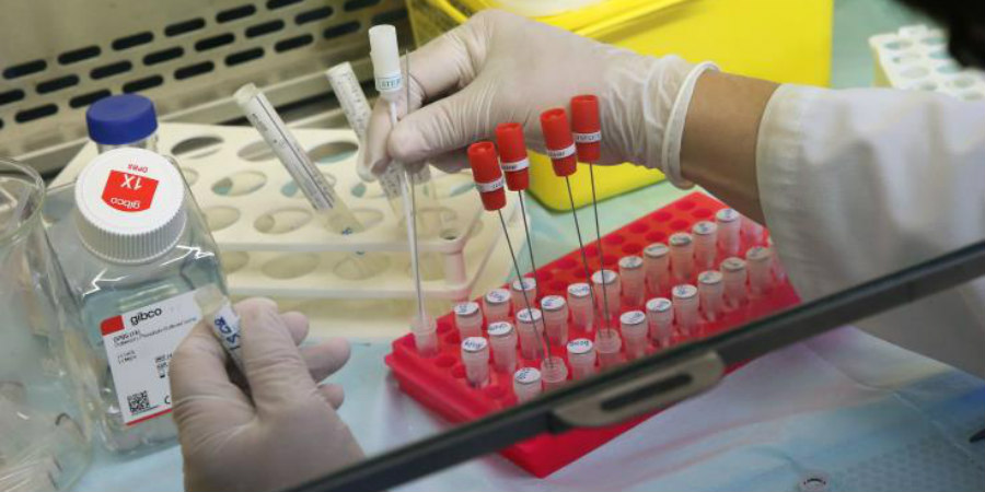 ΚΟΡΩΝΟΪΟΣ: Το Νοσοκομείο Hadassah εφάρμοσε παθητική θεραπεία εμβολίου